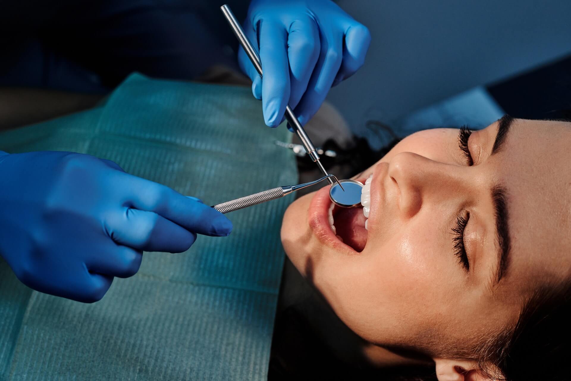 A dentist is about to place dental veneers in Lake Worth on a patient's teeth