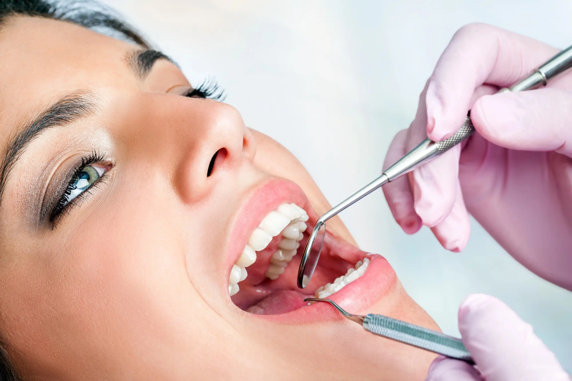 Dentista Que Hable Español en Lake Worth Explica Cómo Diferenciar Caries de Manchas