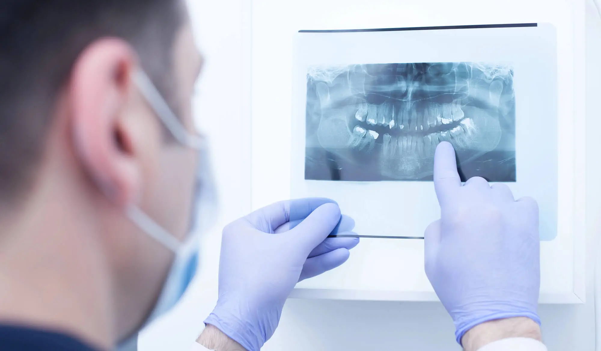Can I Get Dental Implants If I Vape?