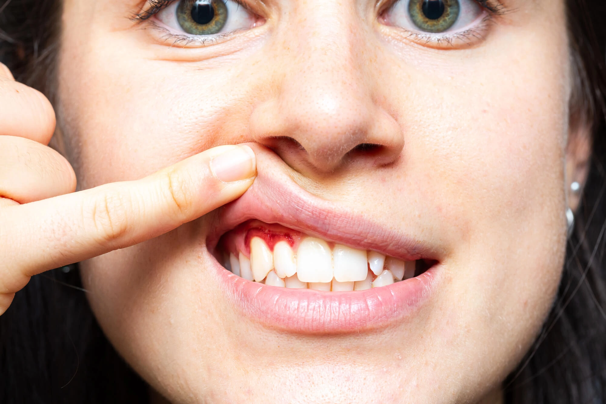 Girl Needing an Emergency Dentist in Lake Worth FL