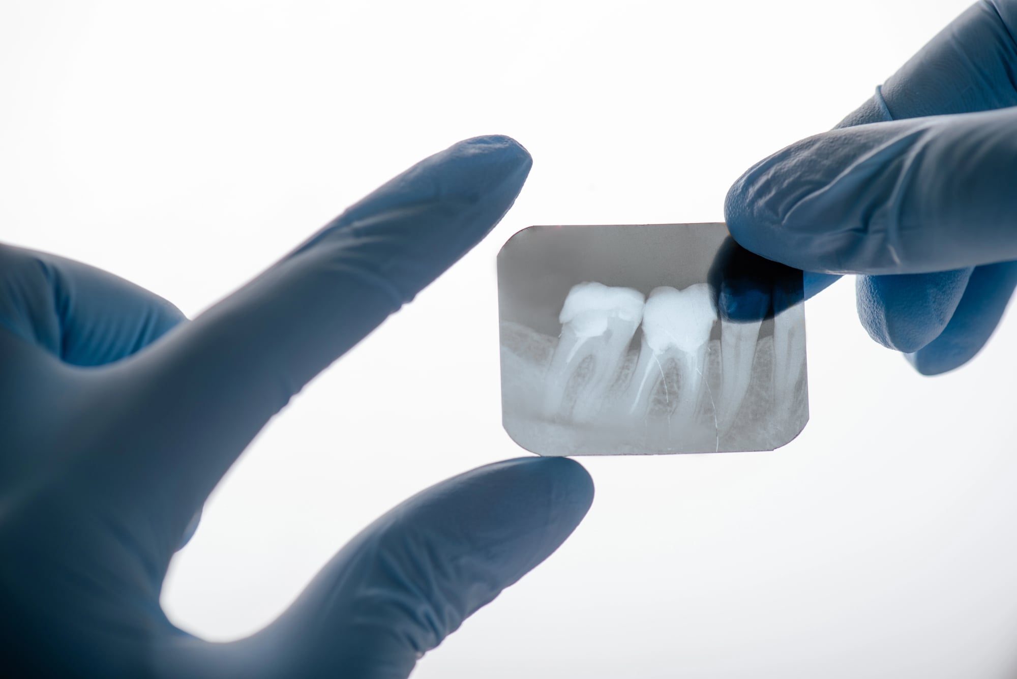 emergency dentist lake worth fl dental xray review