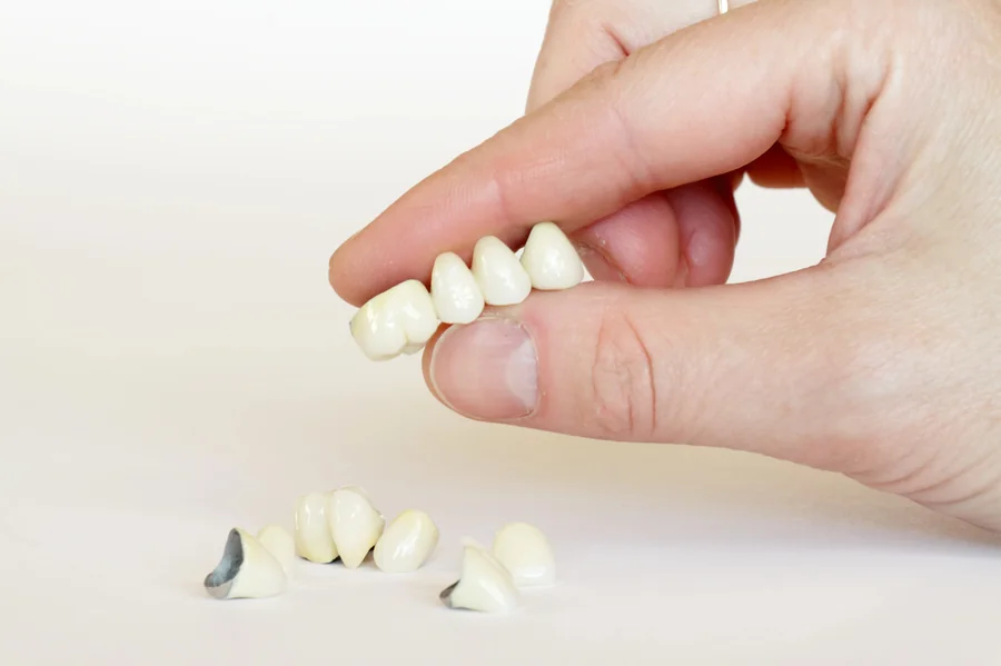 dental-crowns-lake-worth-crown-bridge