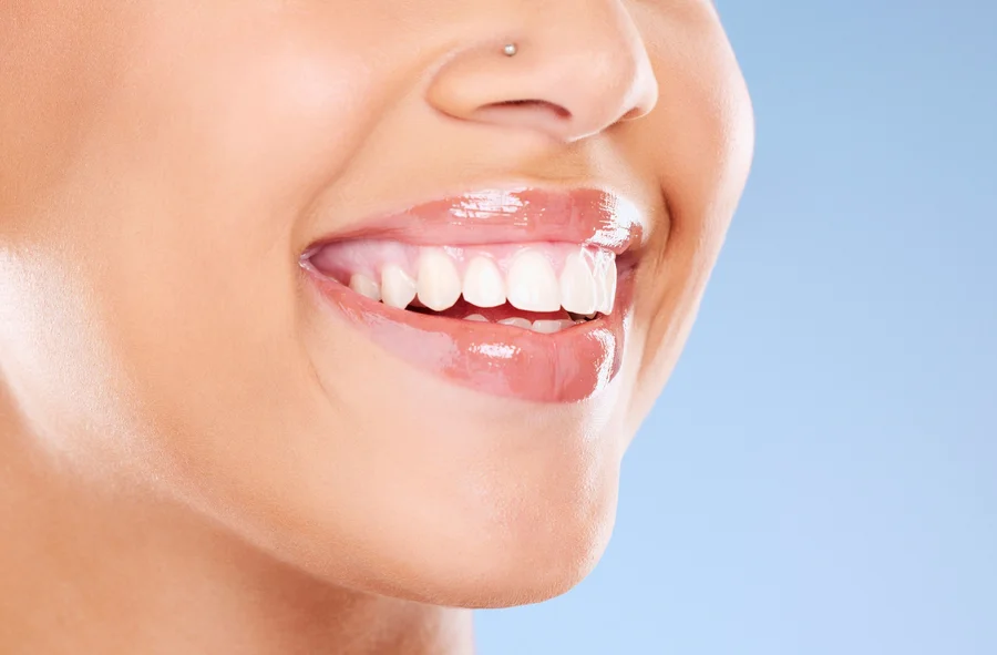 bright smile after cosmetic dentistry treatment lake worth fl